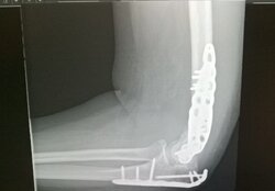 xray1.jpg